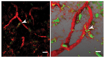 Transit of Tumor Cells Through Lymph Node Vasculature Transit of Tumor Cells Through Lymph Node Vasculature - October 2018 Advances article