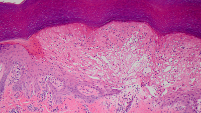 Services Dermatopathology services