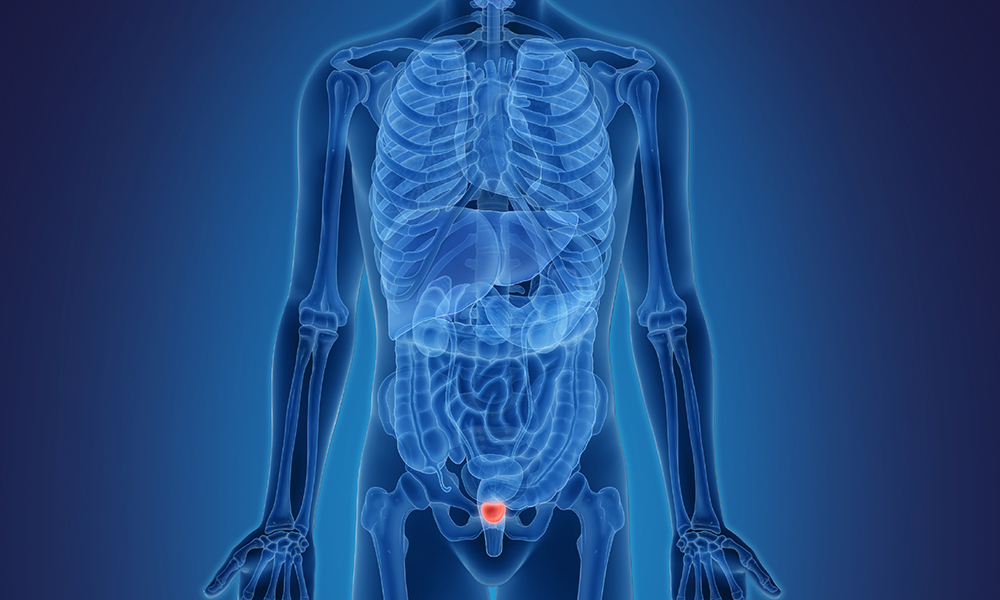 Surgical Outcomes for Prostate Conditions