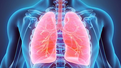 Lung Transplant Lung transplant program