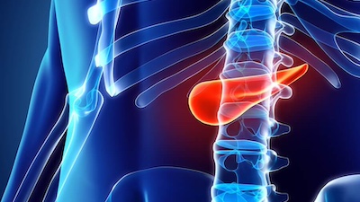 Pancreas Transplant Pancreas Transplant Program