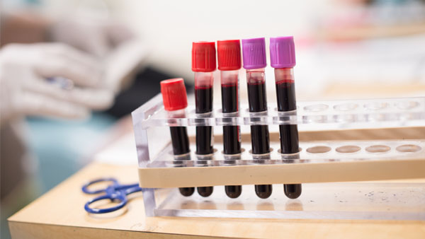 Vials of blood on a counter Vials of blood on a counter